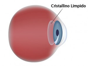 Cristallino